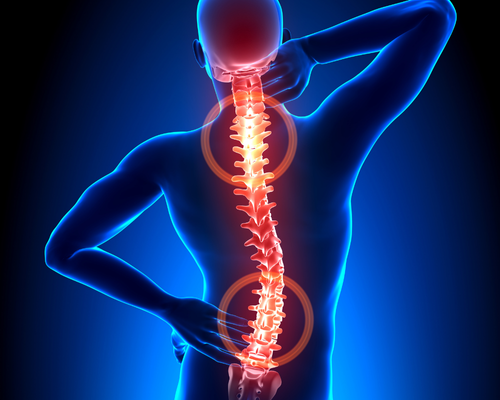 Spine Surgery
